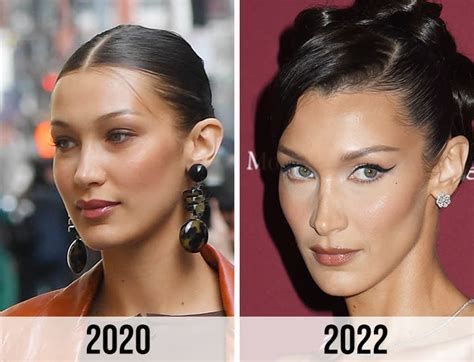 bella hadid buccal fat removal|Everything To Know About Buccal Fat Removal